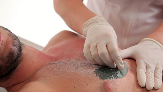 DEPILACION MASCULINA