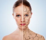 Fro y piel: recomendaciones y productos
