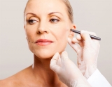 Tendencias actuales en lifting facial 